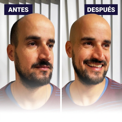 Hamilton FlexSeries - Afeitadora Corporal para Hombre